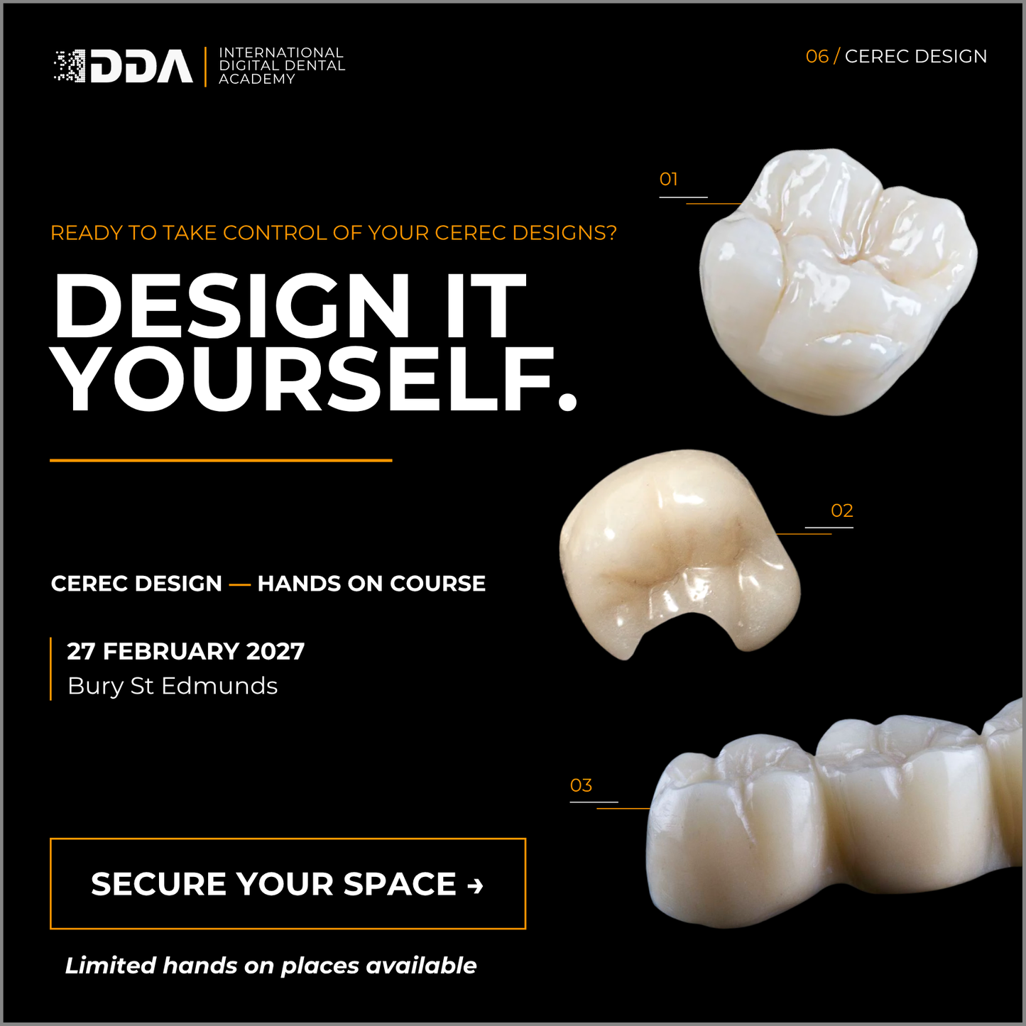 CEREC Design: Same Day Crowns, Onlays and Short Span Bridges with Confidence