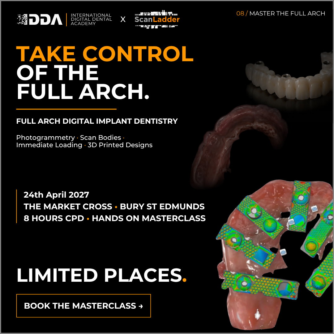 Full-Arch Digital Implant Dentistry: Photogrammetry, Scan Bodies and Immediate Loading 3D Printed Designs