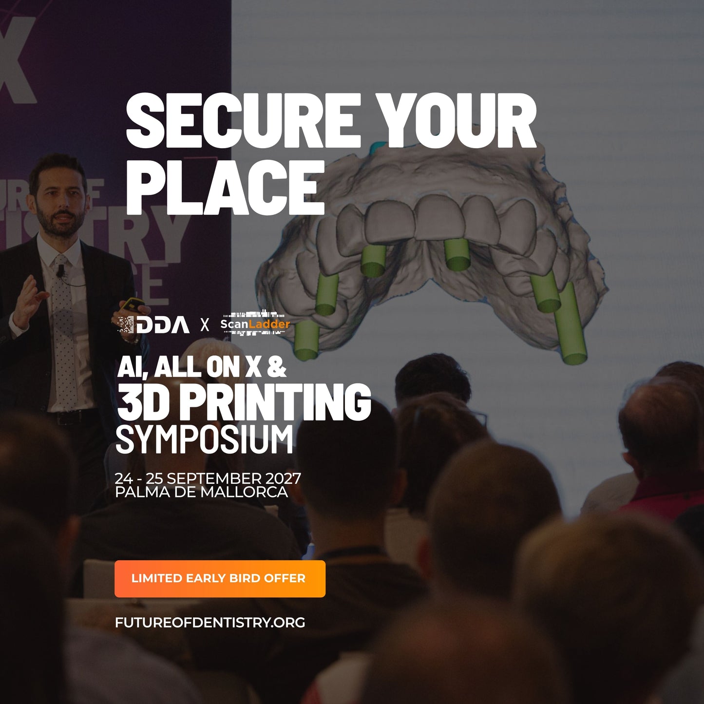 IDDA X Scan Ladder AI, All on X & 3D Printing Symposium