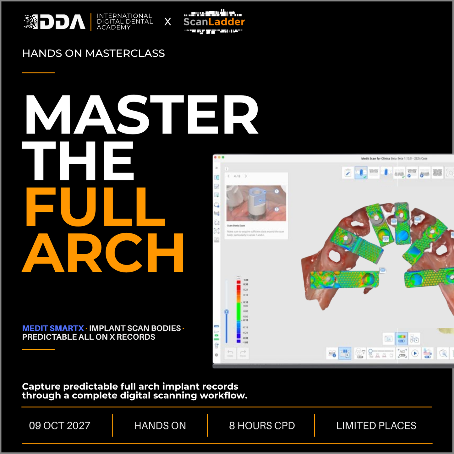 Exocad Master Course – Full Arch Design, Exam & Advanced PGCert Graduation