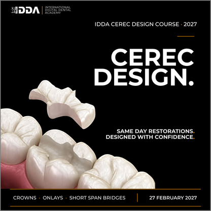 CEREC Design: Same Day Crowns, Onlays and Short Span Bridges with Confidence