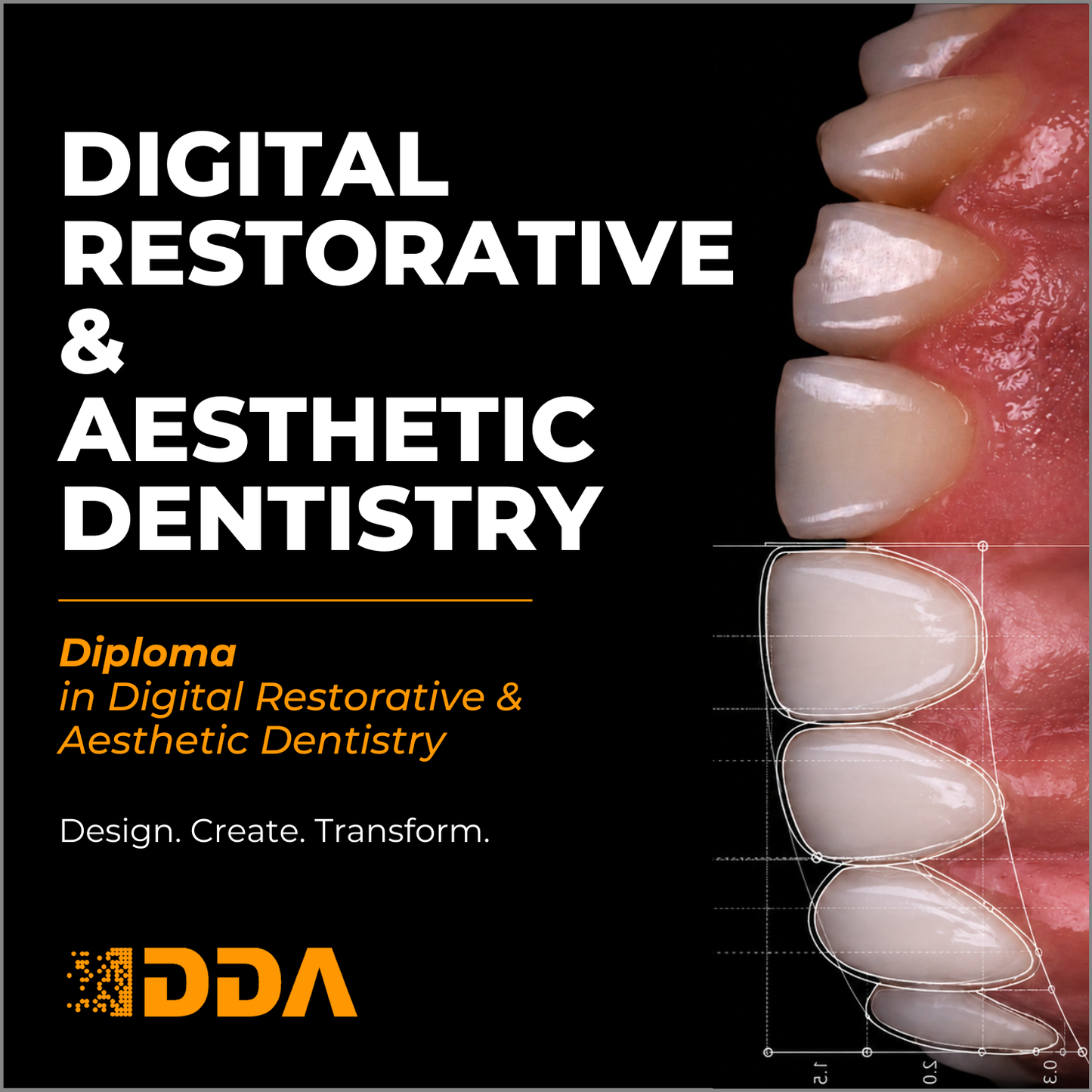 Diploma in Digital Restorative & Aesthetic Dentistry