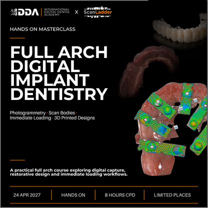 Full-Arch Digital Implant Dentistry: Photogrammetry, Scan Bodies and Immediate Loading 3D Printed Designs