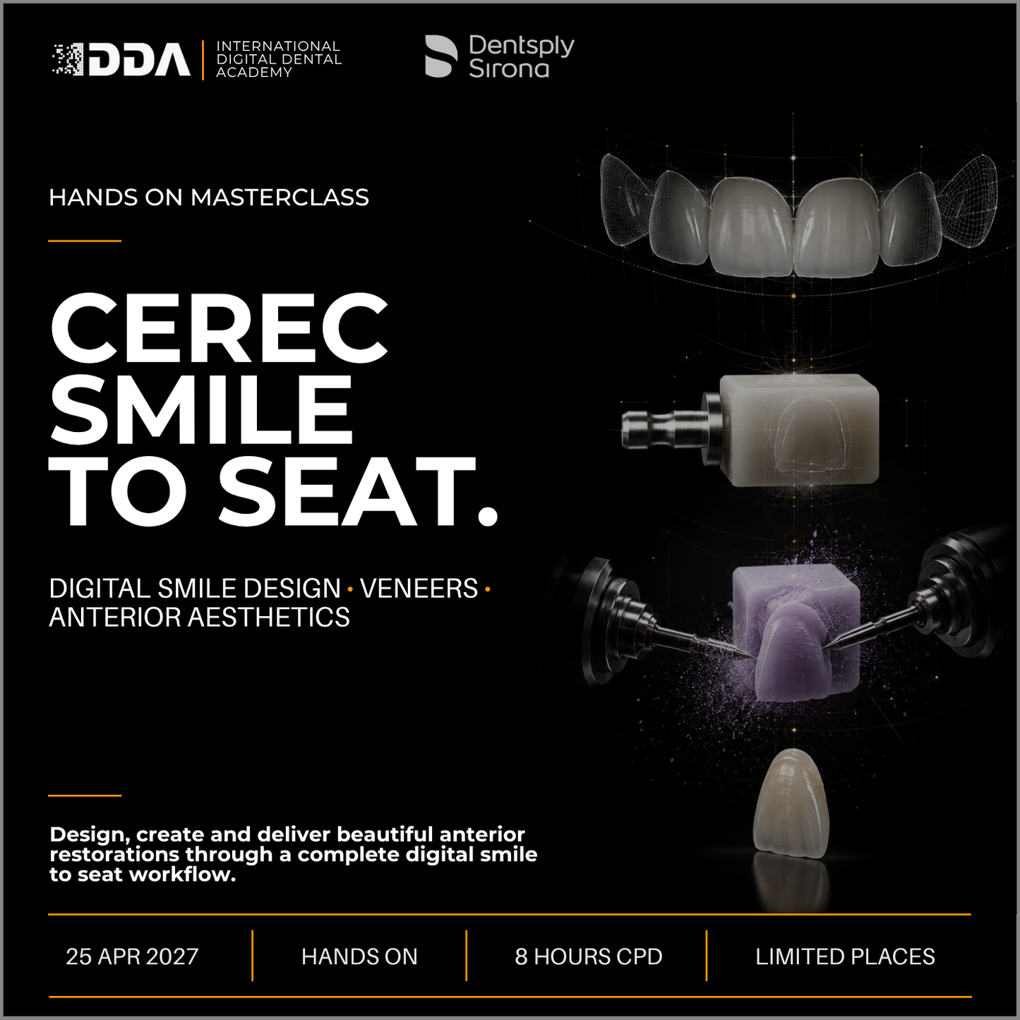 CEREC Smile-to-Seat: Digital Smile Design, Veneers and Anterior Aesthetics