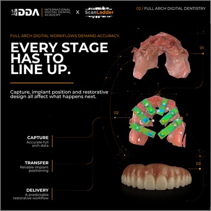 Full-Arch Digital Implant Dentistry: Photogrammetry, Scan Bodies and Immediate Loading 3D Printed Designs