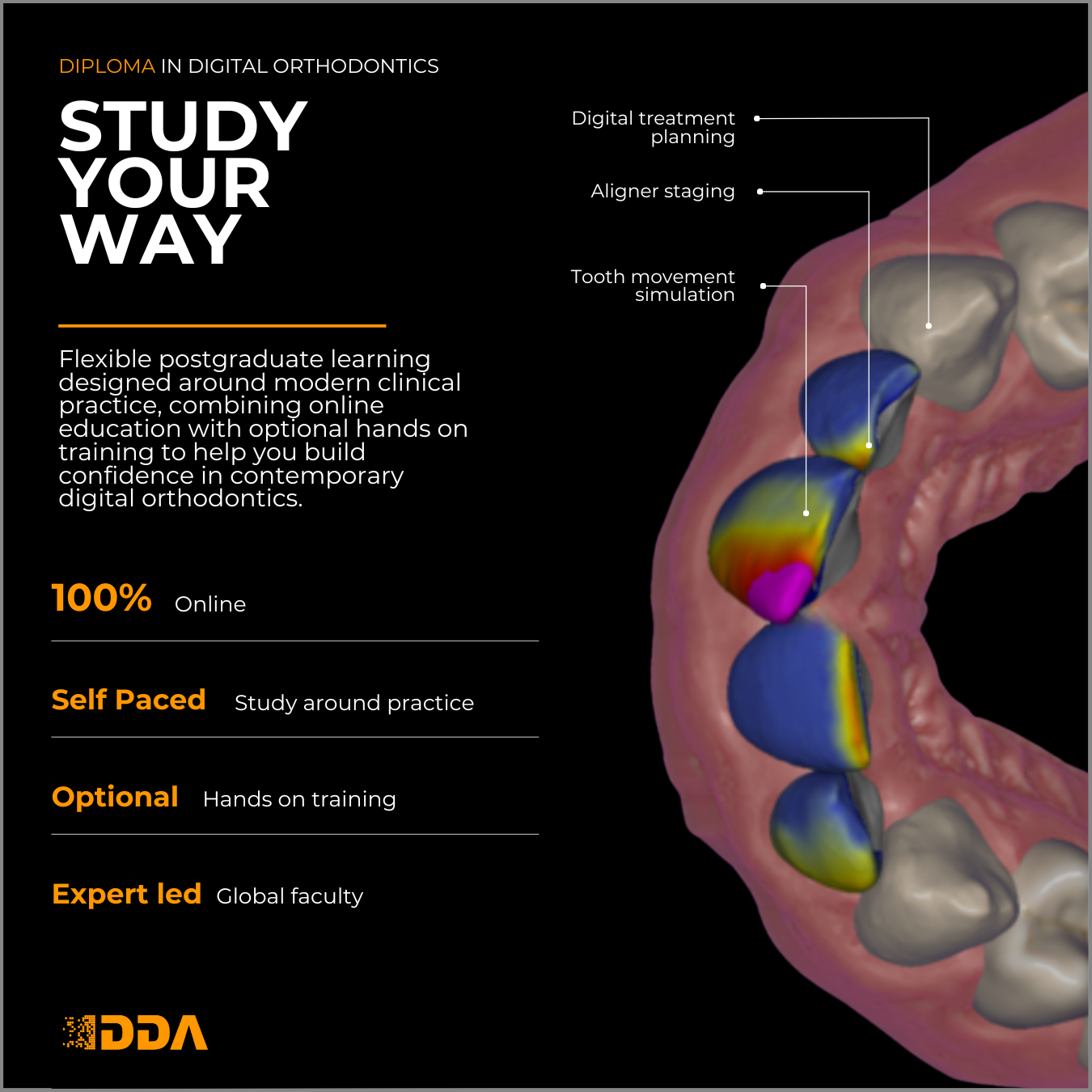 Diploma in Digital Orthodontics & Clear Aligner Treatments