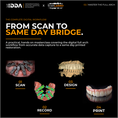 Master the Full Arch: Scanning, All on X Records & Same Day Printed Bridges