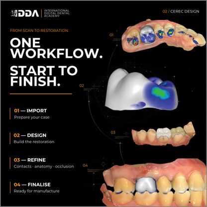 CEREC Design: Same Day Crowns, Onlays and Short Span Bridges with Confidence