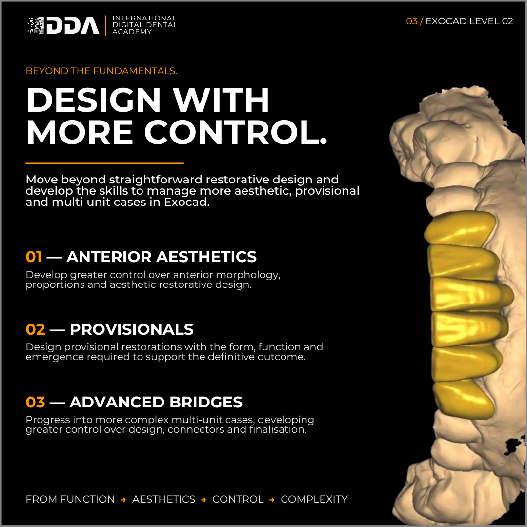 Exocad Level 2: Beyond the Basics - Anterior Aesthetics, Provisionals & Advanced Bridges