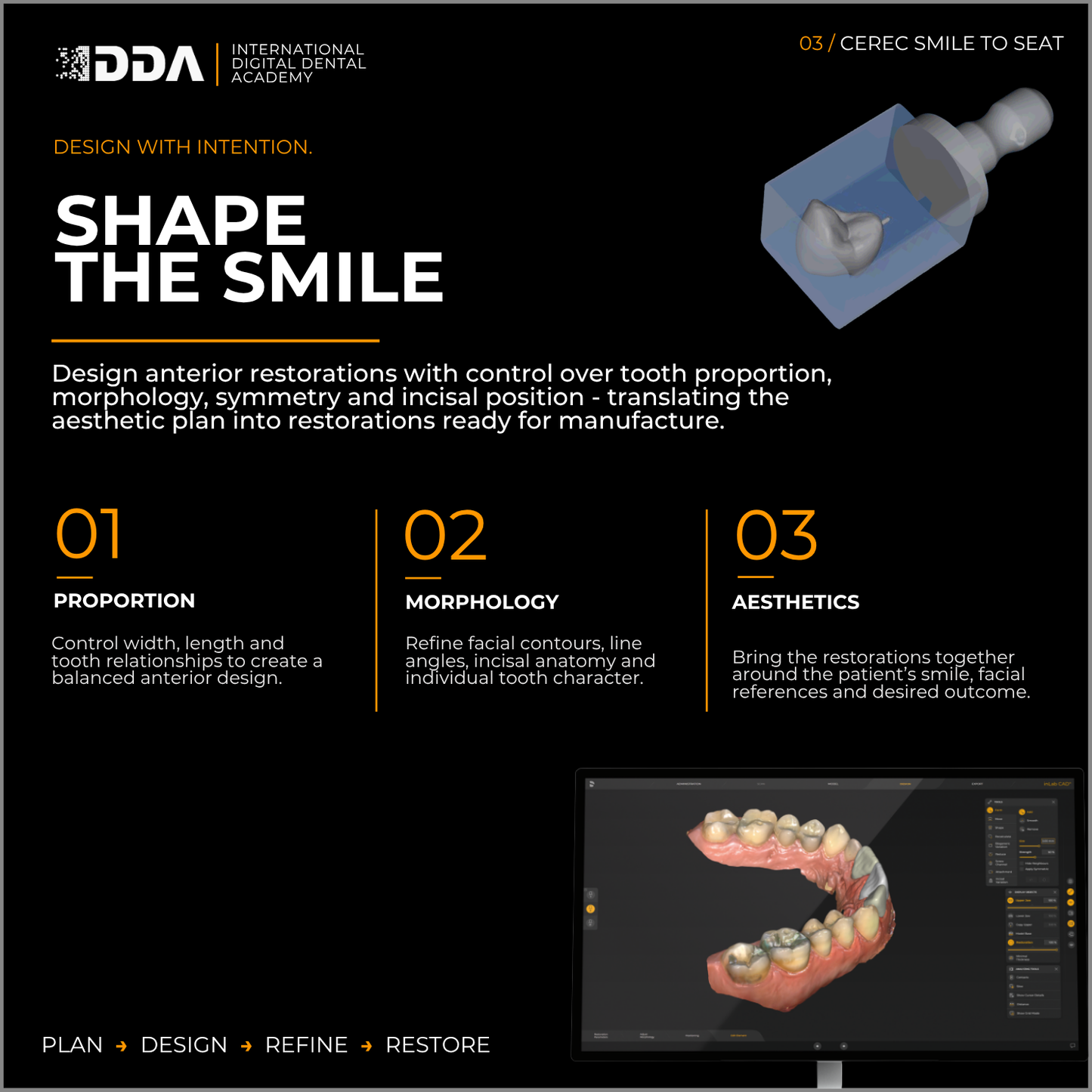CEREC Smile-to-Seat: Digital Smile Design, Veneers and Anterior Aesthetics