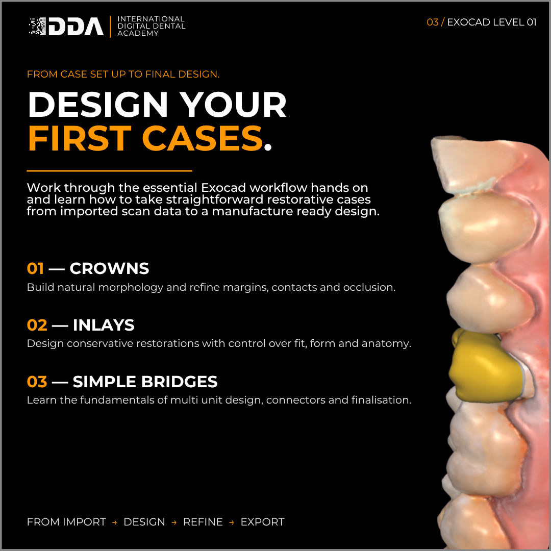 Exocad Level 1: Intro to Exocad - Crowns, Inlays & Simple Bridges