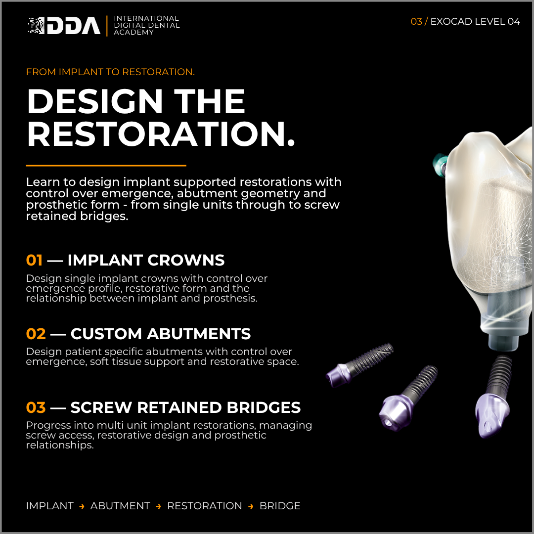 Exocad Level 4: Implant Restorations - Single Crowns, Custom Abutments & Screw Retained Bridges