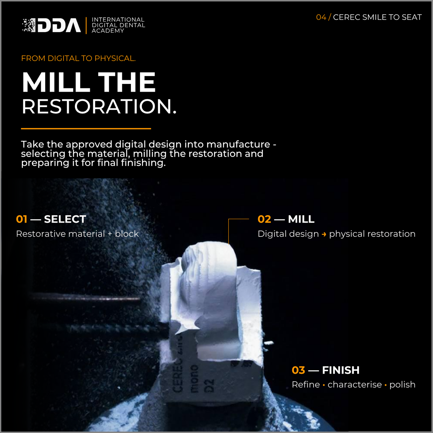 CEREC Smile-to-Seat: Digital Smile Design, Veneers and Anterior Aesthetics