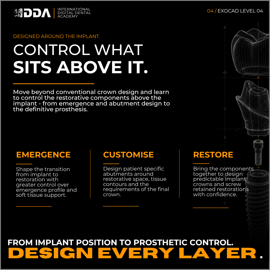 Exocad Level 4: Implant Restorations - Single Crowns, Custom Abutments & Screw Retained Bridges