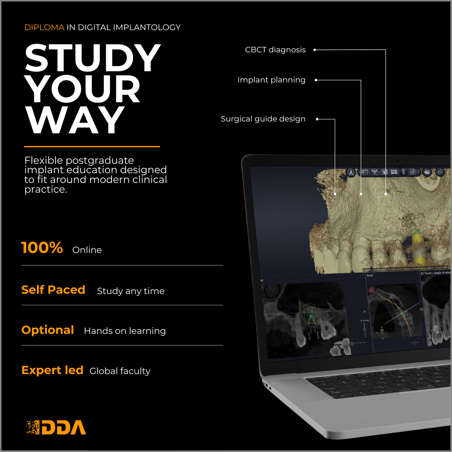 Diploma in Digital Implantology and Guided Surgery