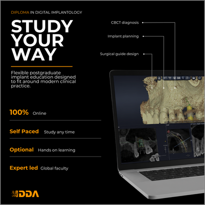 Diploma in Digital Implantology and Guided Surgery
