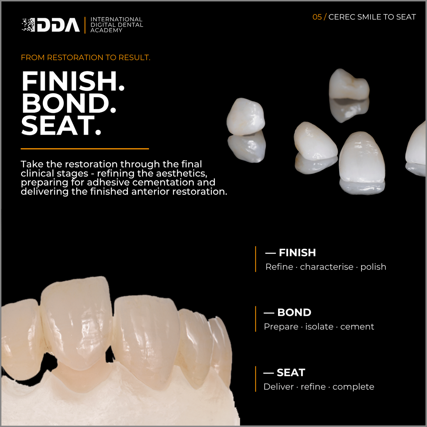 CEREC Smile-to-Seat: Digital Smile Design, Veneers and Anterior Aesthetics
