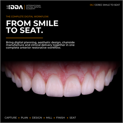 CEREC Smile-to-Seat: Digital Smile Design, Veneers and Anterior Aesthetics