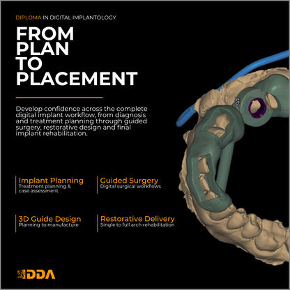 Diploma in Digital Implantology and Guided Surgery