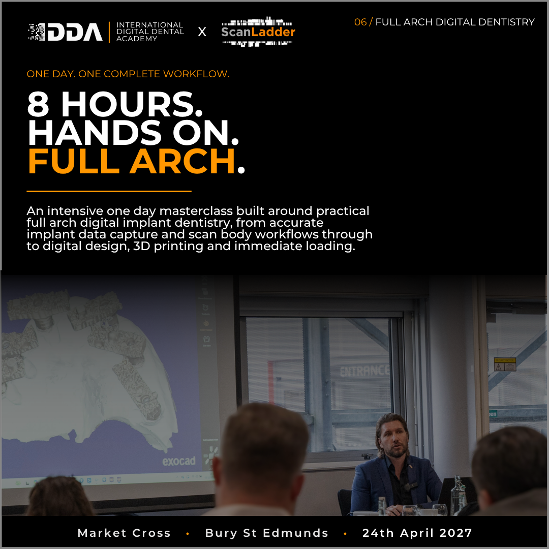 Full-Arch Digital Implant Dentistry: Photogrammetry, Scan Bodies and Immediate Loading 3D Printed Designs