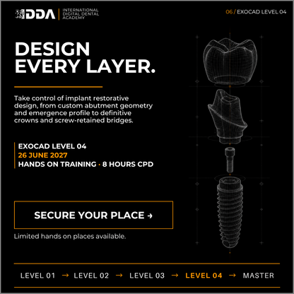 Exocad Level 4: Implant Restorations - Single Crowns, Custom Abutments & Screw Retained Bridges