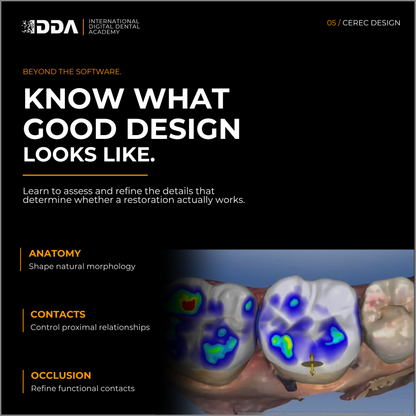 CEREC Design: Same Day Crowns, Onlays and Short Span Bridges with Confidence