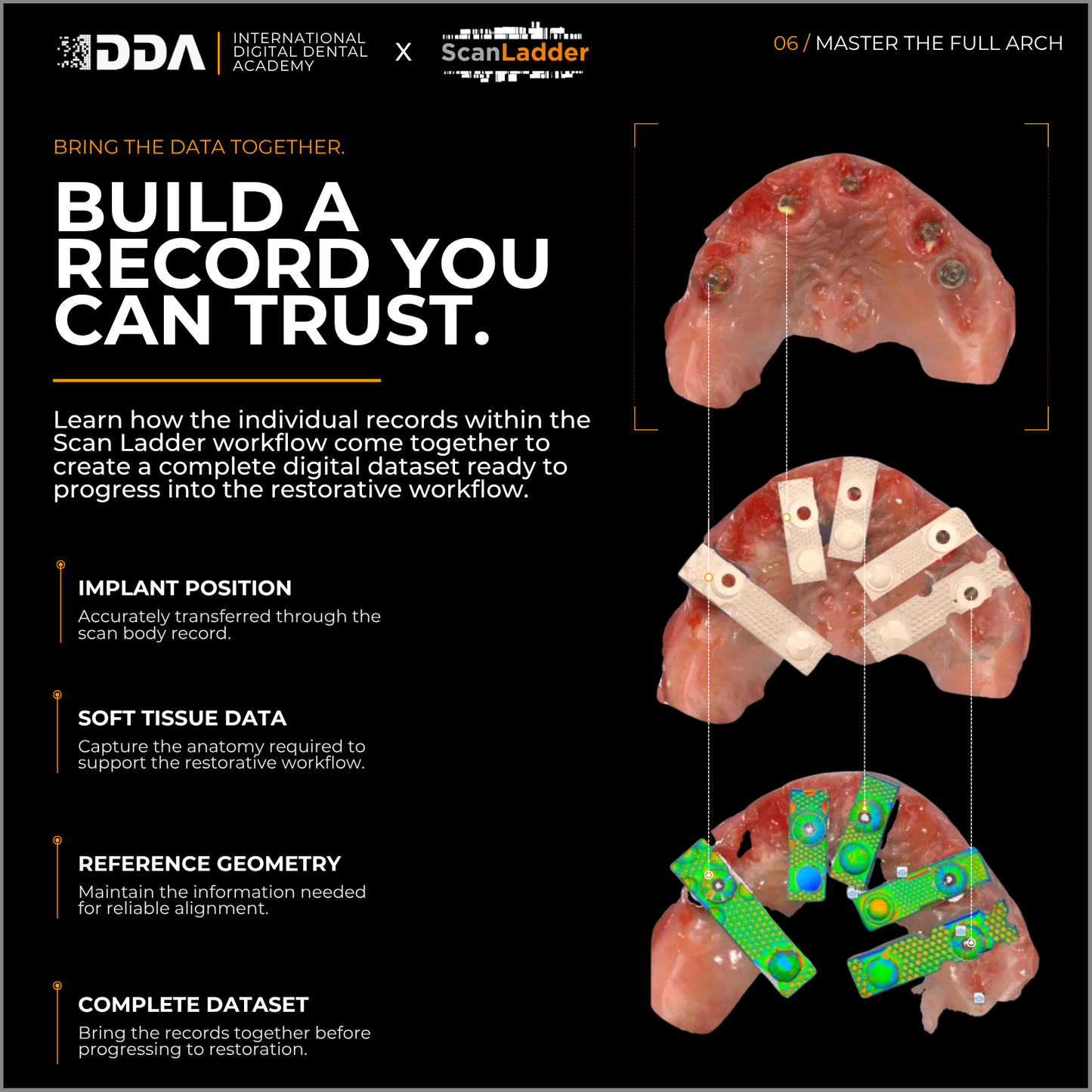 Exocad Master Course – Full Arch Design, Exam & Advanced PGCert Graduation