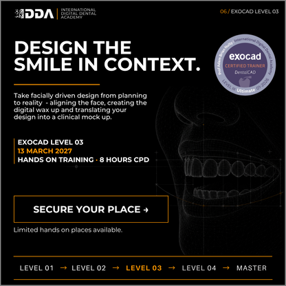 Exocad Level 3: Smile Creator - From Face Scan to Digital Wax Up & Mock Up