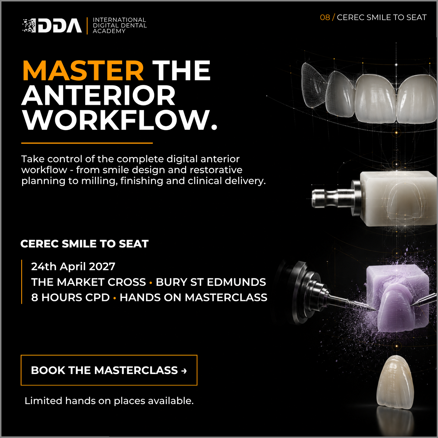 CEREC Smile-to-Seat: Digital Smile Design, Veneers and Anterior Aesthetics