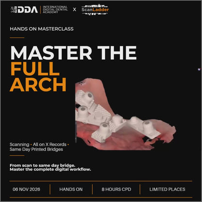 Master the Full Arch: Scanning, All on X Records & Same Day Printed Bridges