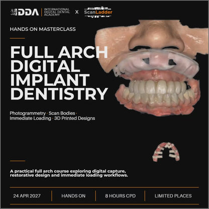 Full-Arch Digital Implant Dentistry: Photogrammetry, Scan Bodies and Immediate Loading 3D Printed Designs